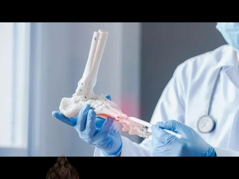 "غراء عظمي".. ابتكار صيني لعلاج الكسور في 3 دقائق